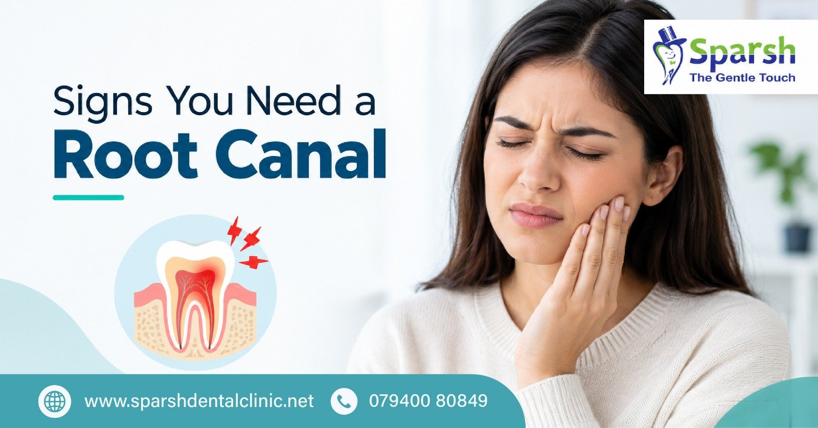 Signs You Need a Root Canal